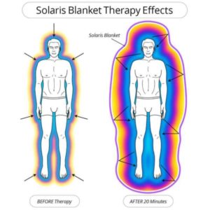 Solaris Blanket Therapy Effects