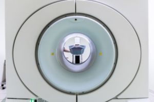 Dr. Diane has bad reaction to MRI dye