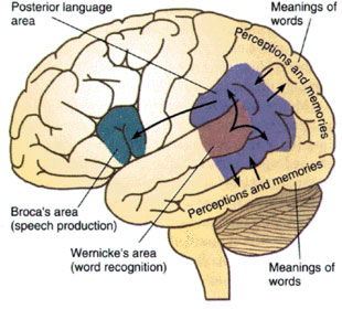 Where Aphasia Affects the Brain