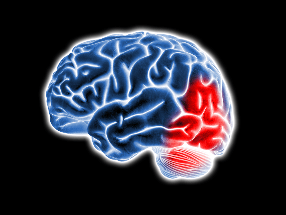 An illustration of a brain having a stroke or "brain attack." The brain is outlined in glowing white on a black background, the aneurysm is highlighted in glowing red. 