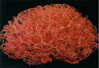 Brain vasculature image courtesy of hive76.org