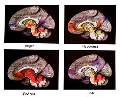 Brain Scan showing the Norepinephrine System at work