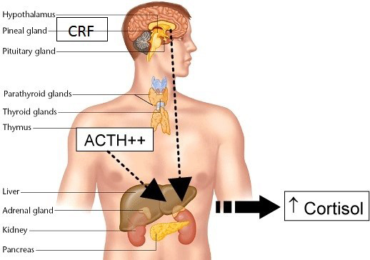 Graphic of the human body showing the organs that react to stress.