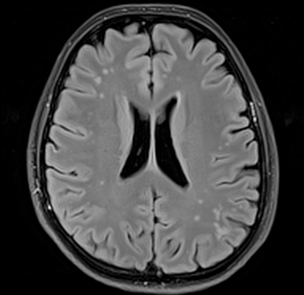 T3 MRI image courtesy of www.german-diagnostic.md