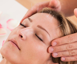 acupuncture for chronic headaches