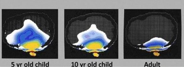 Thermal-Effects-on-Children