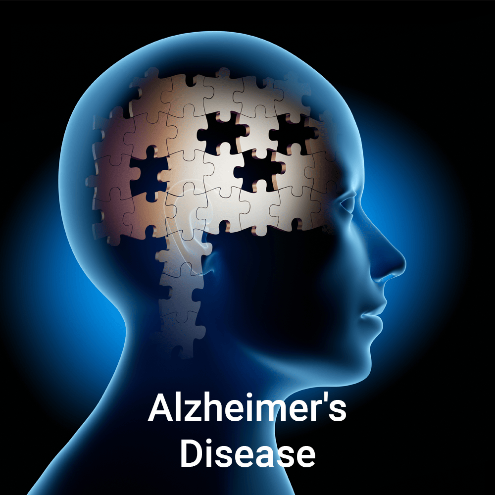 Alzheimer's Disease Graphic